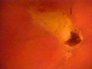 肛門科 腸内カメラ・脱糞 盗撮2